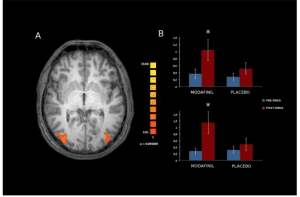Acute effects of Modafinil on brain resting state networks in young healthy individual.